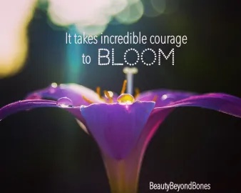 Dormant does not mean dead. Especially when it comes to our heart garden. How recovery plays into our ability to love, and just what happens when our heart finally blooms! #recovery #anorexia #eatingdisorder #edrecovery #healing #mentalhealth #god #bible #catholic #christianity 