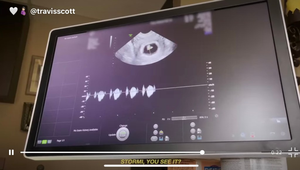 Kylie Jenner announces her pregnancy with a powerful prolife video that has been seen by 135 MILLION people. In the shadow of the Texas Abortion Law, will this famous young woman transform hearts? #texas #prolife #catholic #faith #kyliejenner #pregnant #christianity #womensrights #feminism #kardashian 